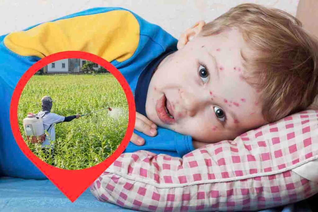 puntini rossi sul corpo del bambino varicella